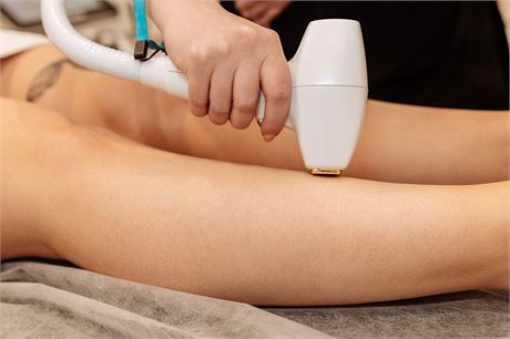 Full Body Laser Hair Removal ($4000 Value) from Flirt Cosmetics in Cochrane
