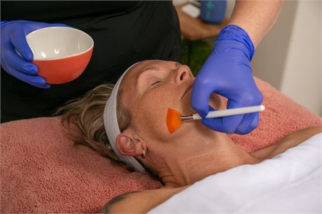 3 Custom Chemical Peels ($370 Value) from Quench Clinical Aesthetics in Cochrane