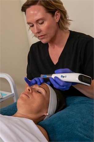 Microneedling -Face ($300 Value) from Quench Clinical Aesthetics in Cochrane